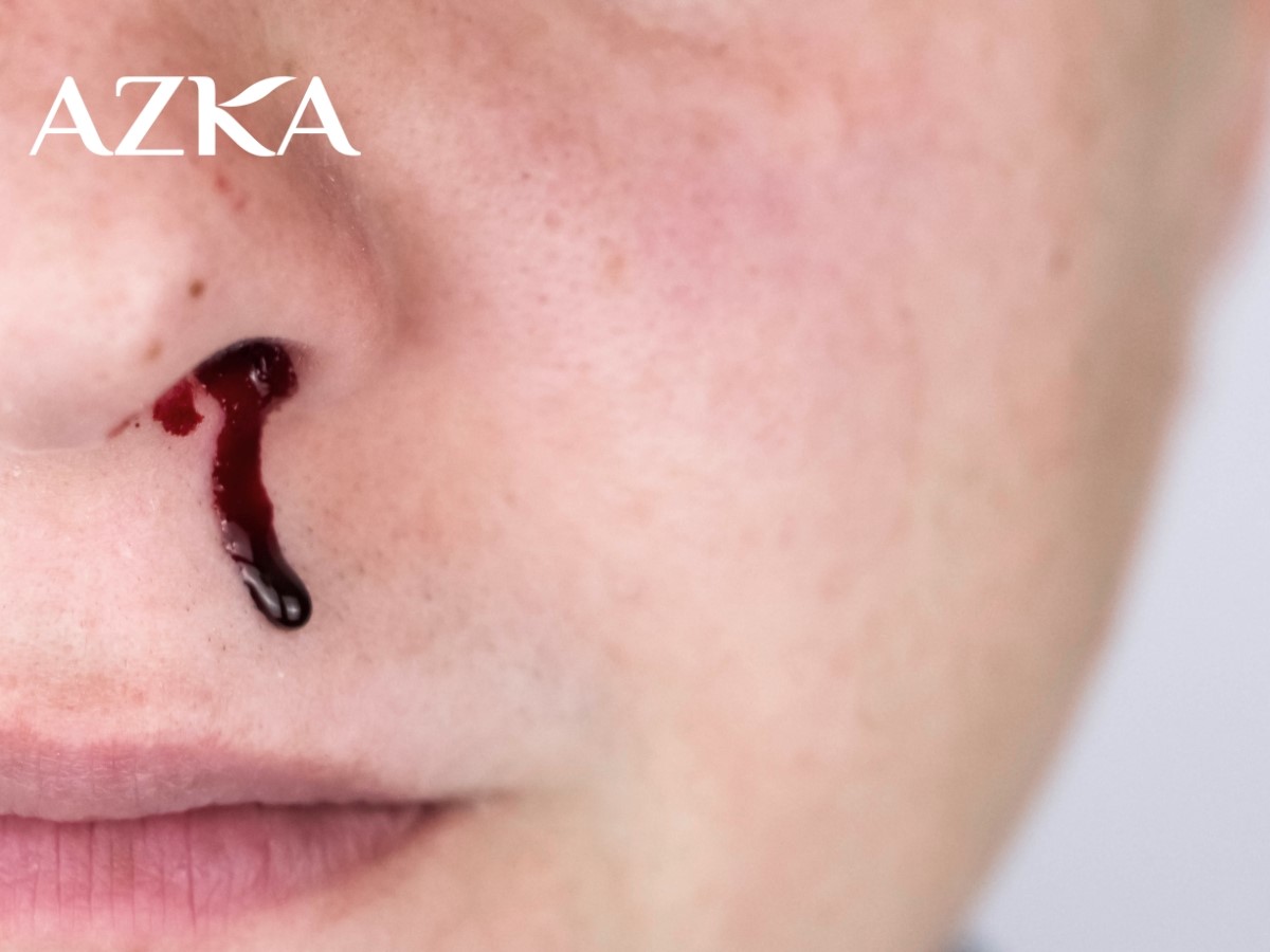 Ngạt mũi ở 1 bên có thể là do vẹo vách ngăn mũi