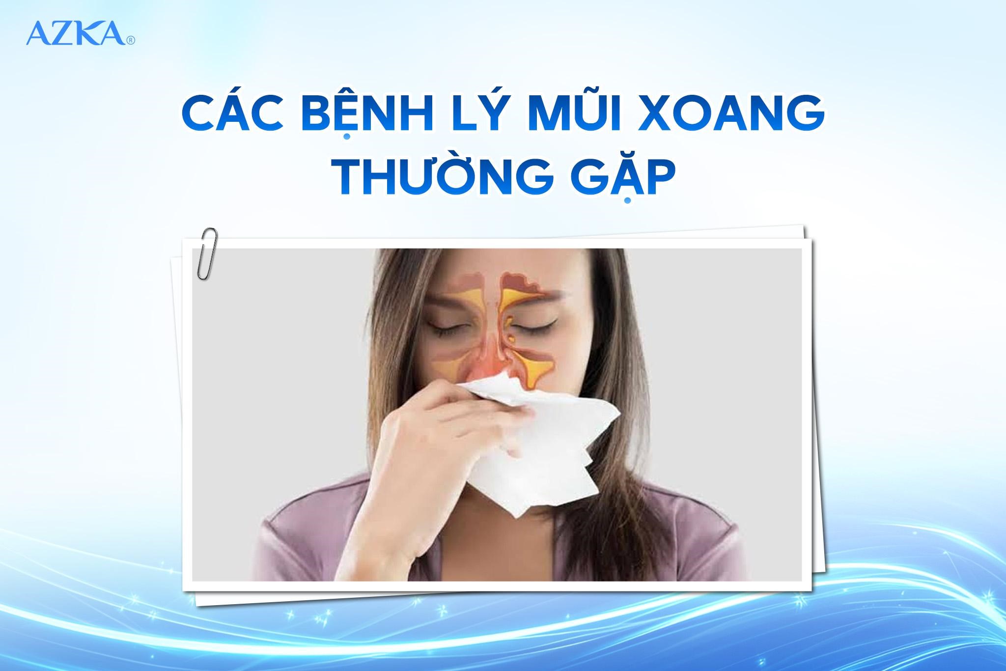 Các bệnh lý mũi xoang thường gặp
