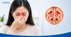 Nghẹt mũi dị ứng: Dấu hiệu, cách xử trí và phòng ngừa tái phát