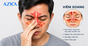 Phân biệt viêm xoang và viêm mũi: Dấu hiệu nhận biết và cách xử lý
